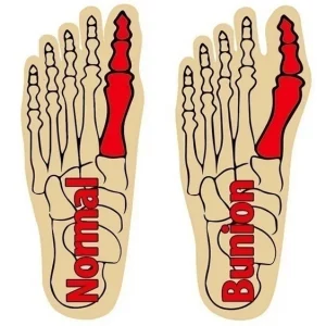 Toes Separator Socks Thumb Adjuster